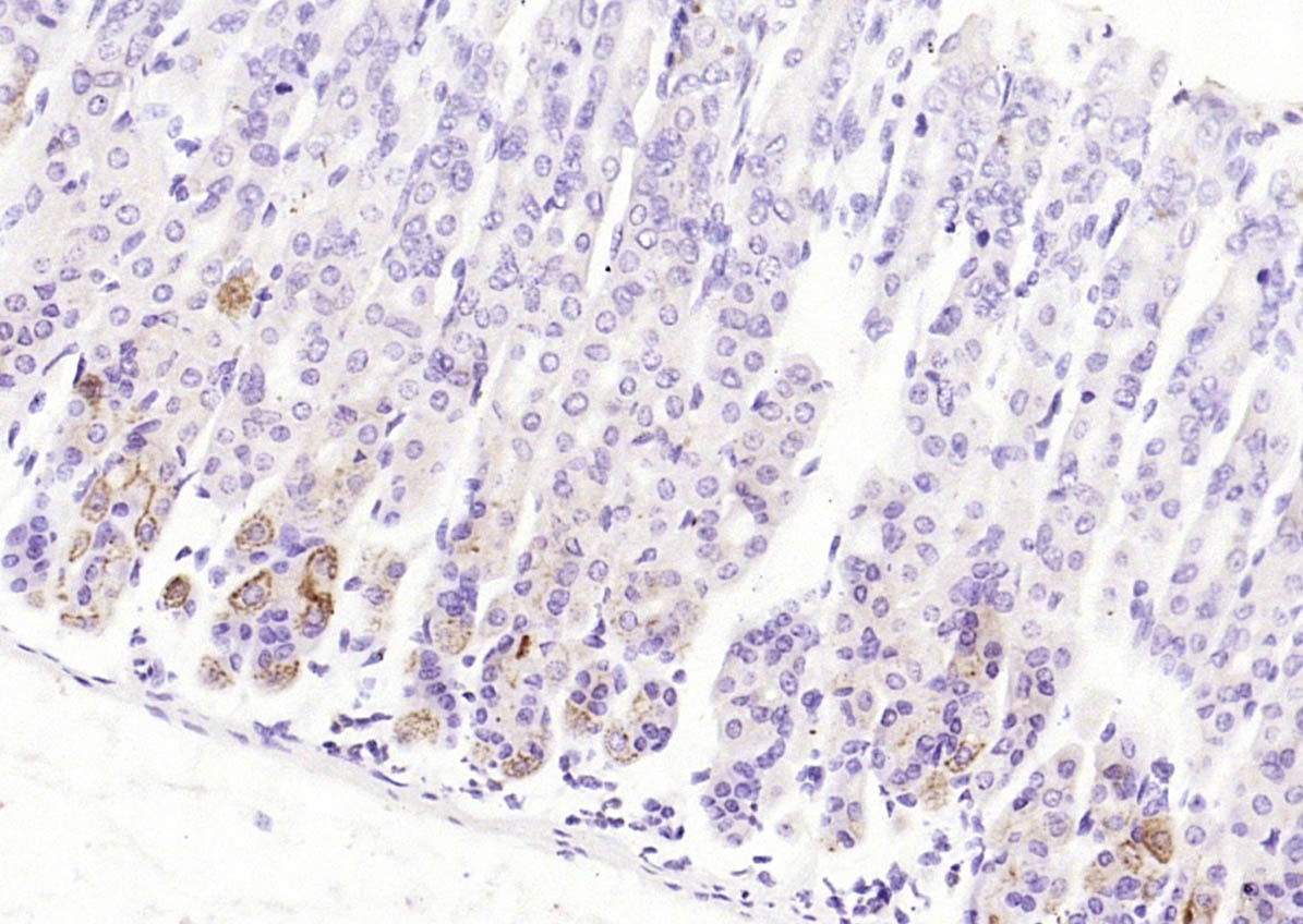 Anti-CCDC80 Polyclonal Antibody