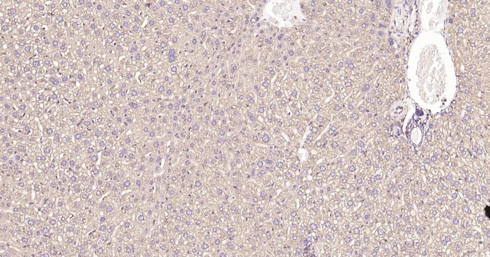 Anti-Calreticulin Antibody (3C852)