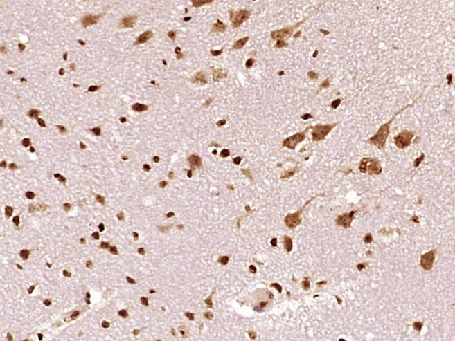 Anti-CBS Polyclonal Antibody