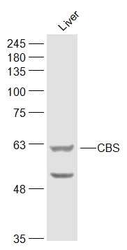 Anti-CBS Polyclonal Antibody