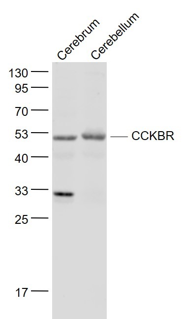 Anti-CCKBR Polyclonal Antibody