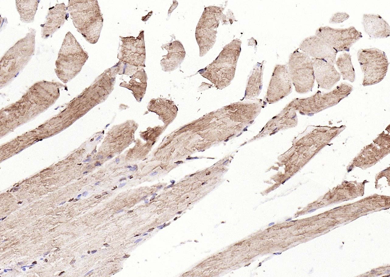 Anti-Calreticulin Antibody (6Q988)