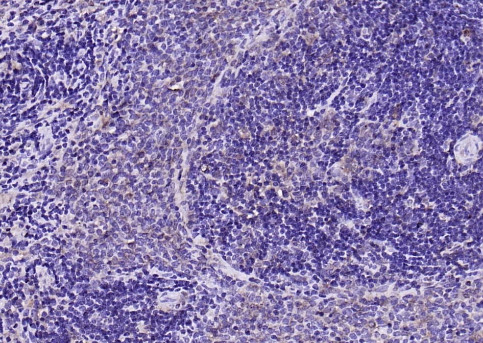 Anti-CALM1 Polyclonal Antibody