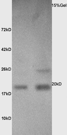Anti-CALM1 Polyclonal Antibody