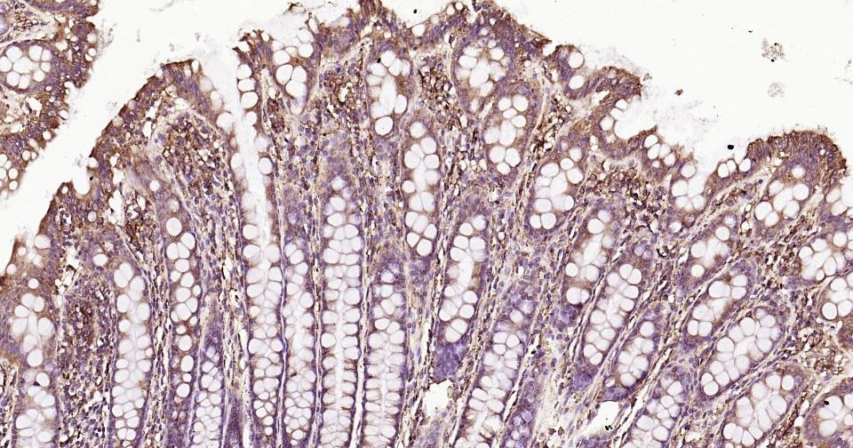 Anti-Calreticulin Polyclonal Antibody