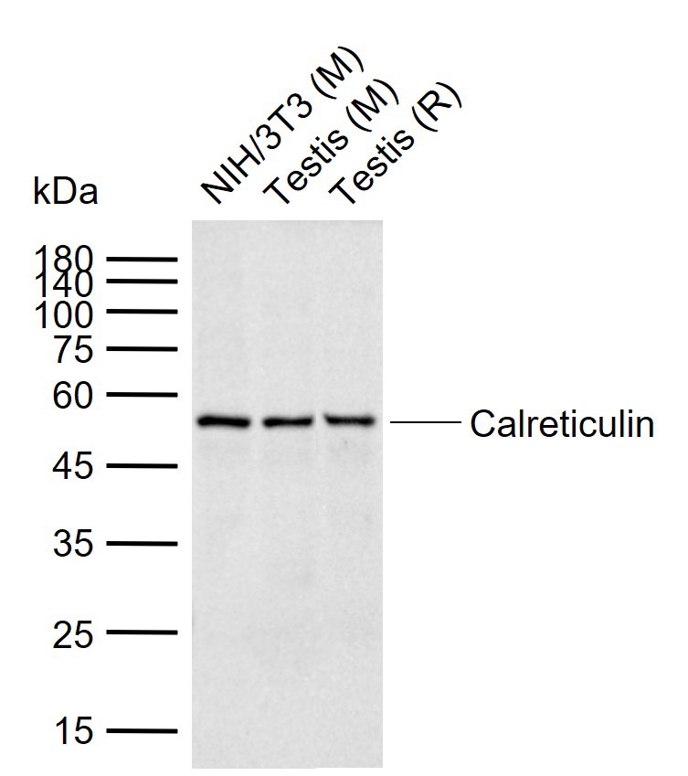 Anti-Calreticulin Antibody (6Q988)