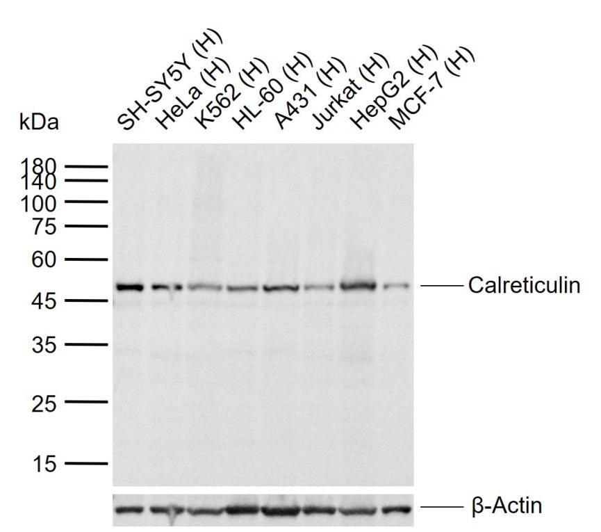 Anti-Calreticulin Antibody (6Q988)