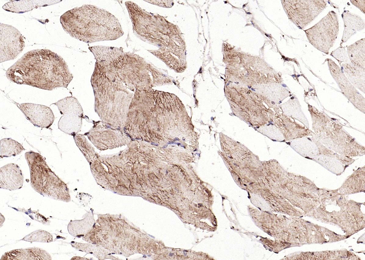 Anti-Calreticulin Antibody (6Q988)