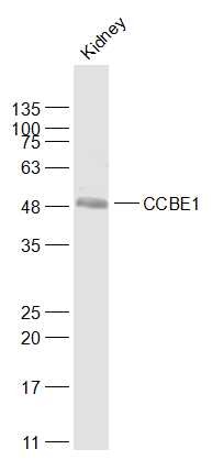 Anti-CCBE1 Polyclonal Antibody