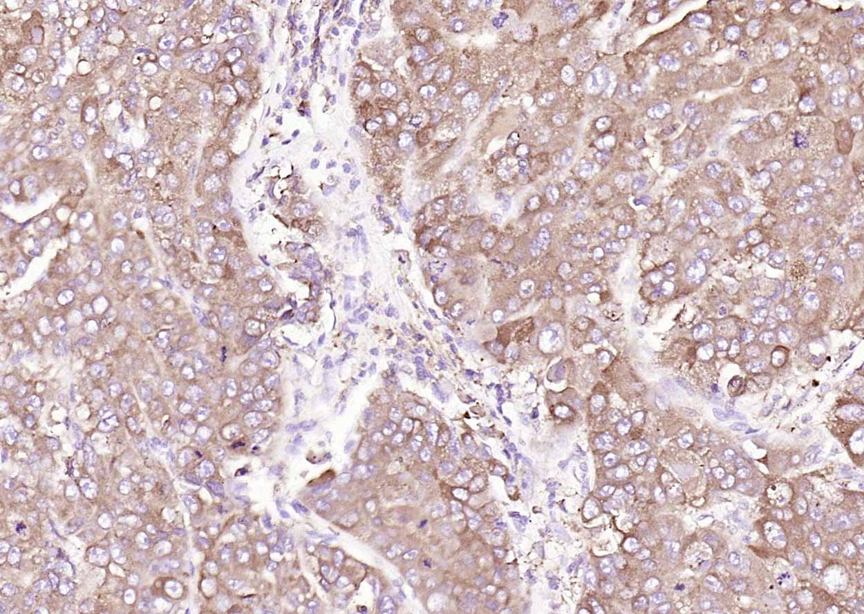Anti-Calreticulin Antibody (6Q988)