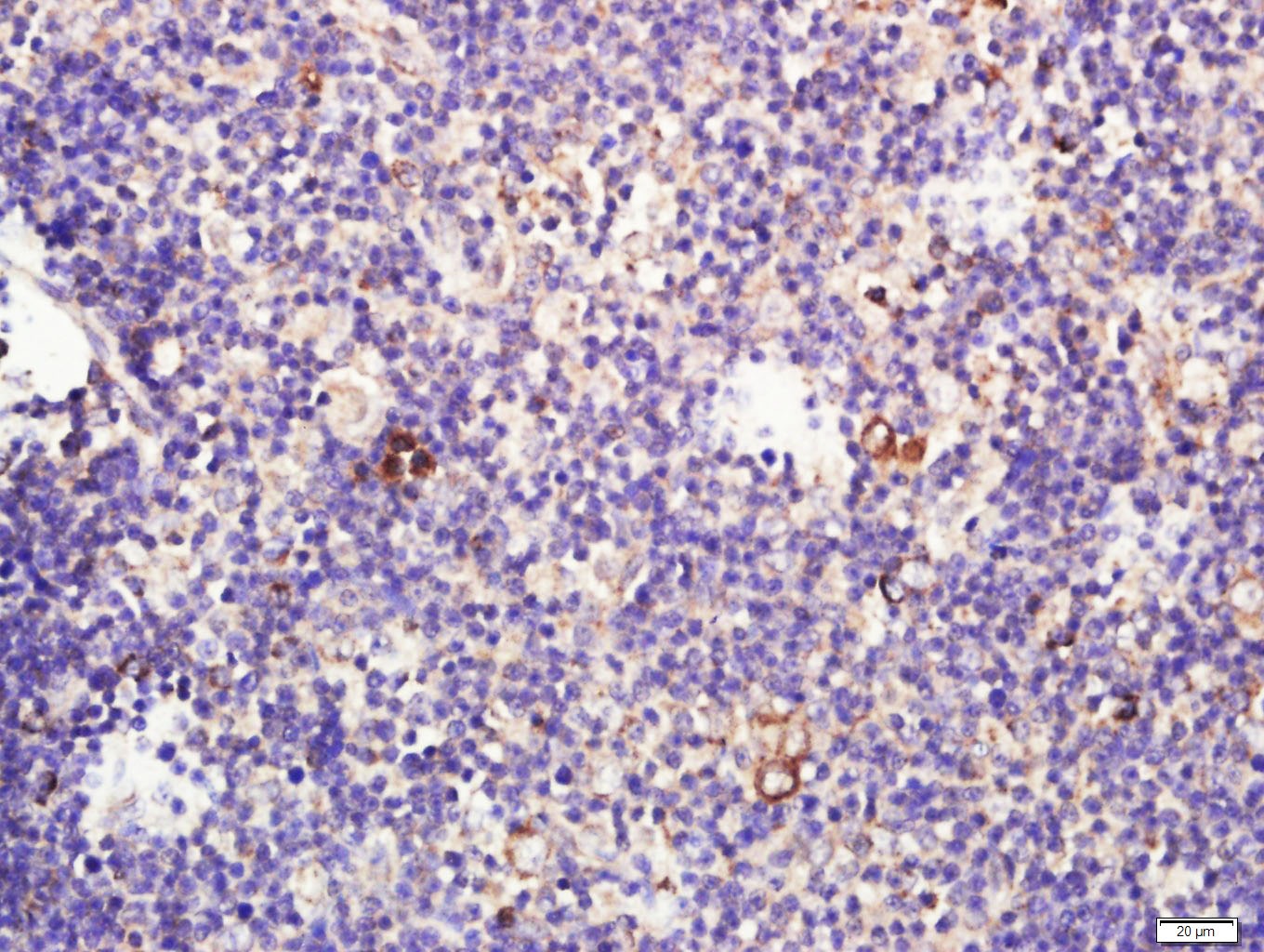 Anti-CCL25 Polyclonal Antibody