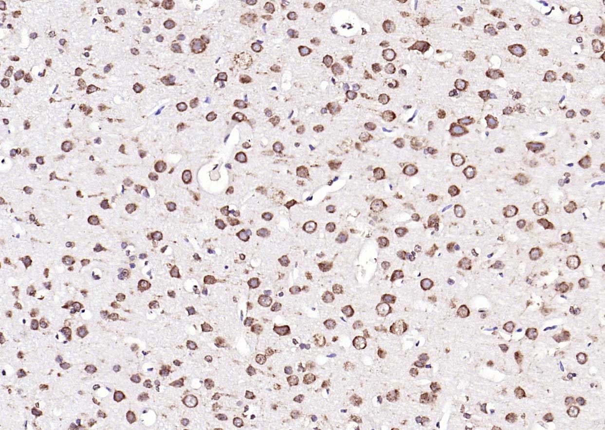 Anti-Calreticulin Antibody (6Q988)