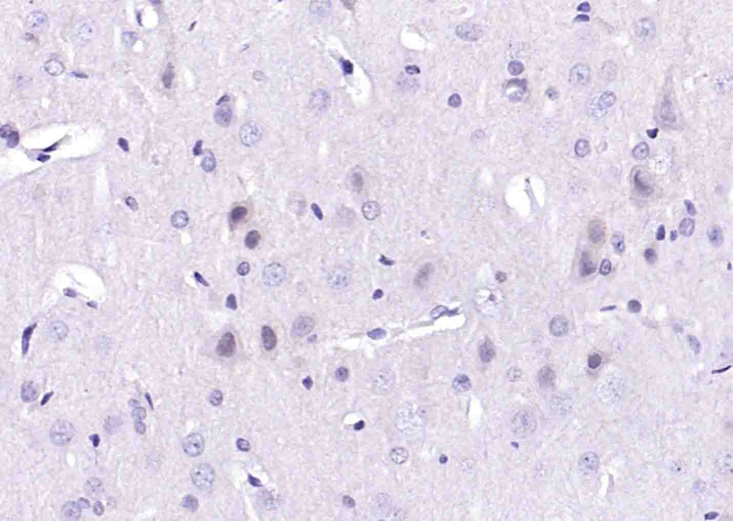 Anti-BRCA2 Polyclonal Antibody