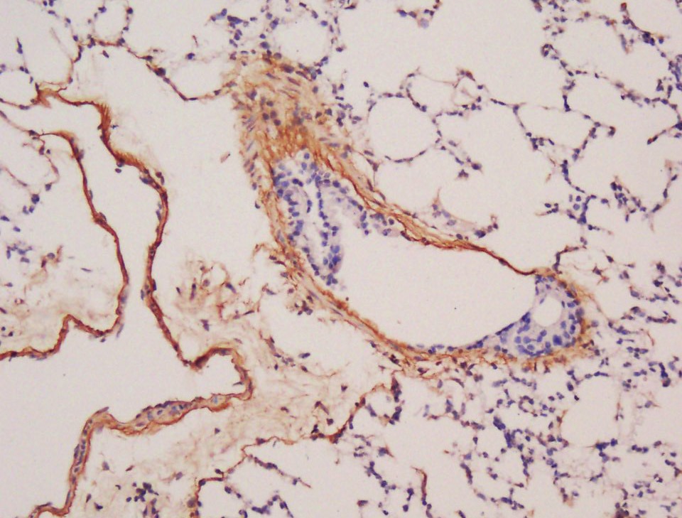 Anti-BMP-6 Polyclonal Antibody