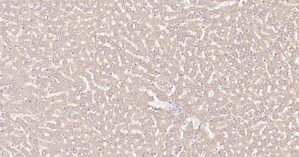 Anti-Calreticulin Antibody (3C852)