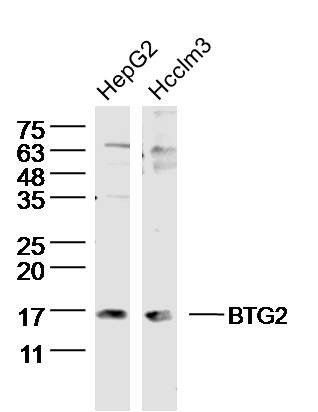 Anti-BTG2 Polyclonal Antibody