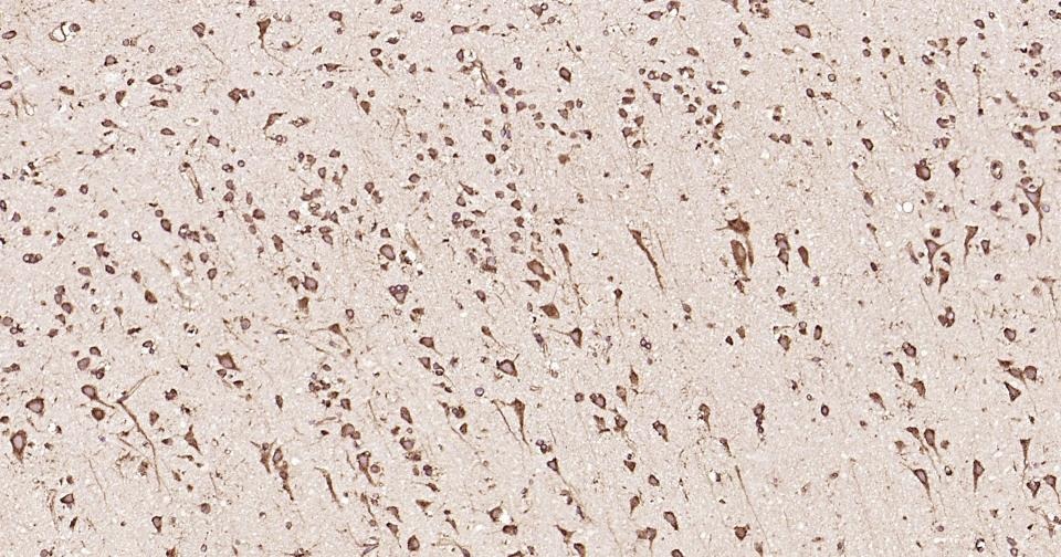 Anti-Calreticulin Antibody (3C852)