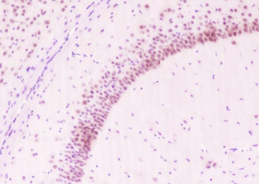 Anti-BMAL1 Antibody (6E793)