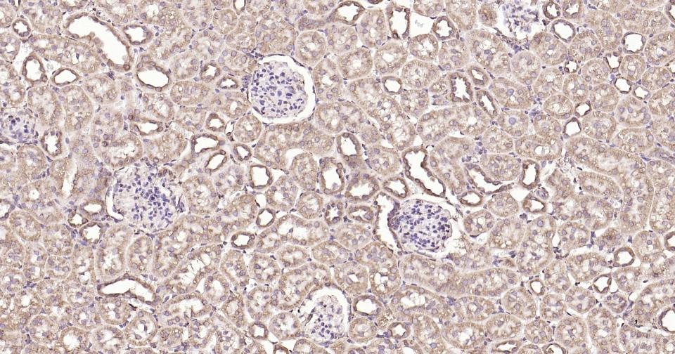 Anti-Calreticulin Antibody (3C852)