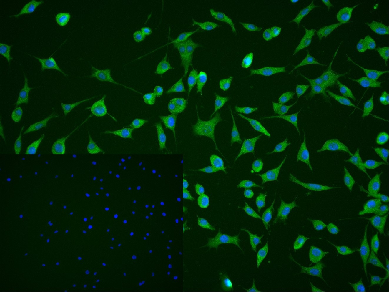 Anti-CAMK2 alpha Polyclonal Antibody 2