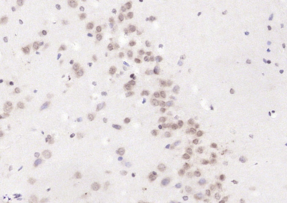 Anti-CAMTA1 Polyclonal Antibody