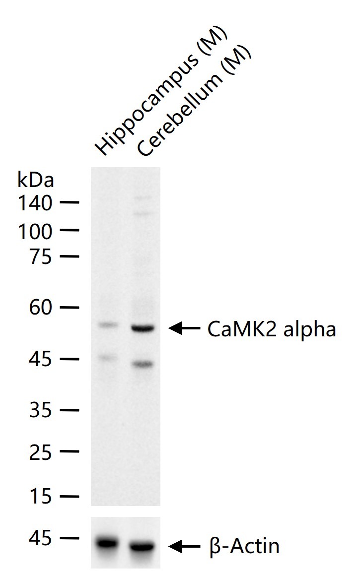 Anti-CAMK2 alpha Polyclonal Antibody 2