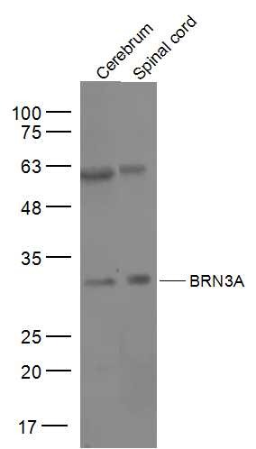 Anti-BRN3A Polyclonal Antibody