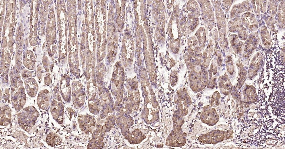 Anti-Calreticulin Antibody (3C852)