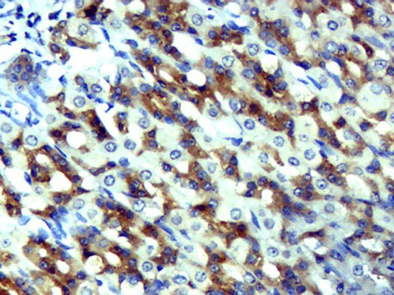 Anti-CCL5 Polyclonal Antibody