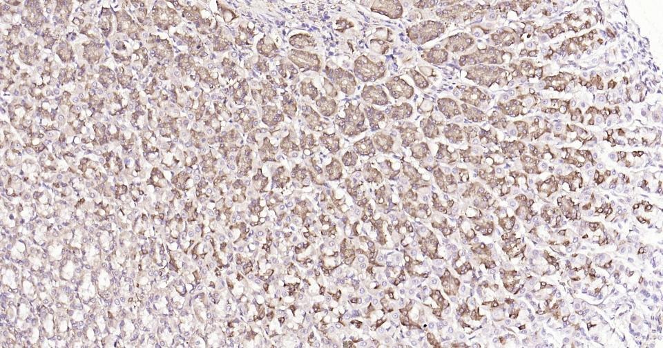 Anti-Calreticulin Antibody (3C852)