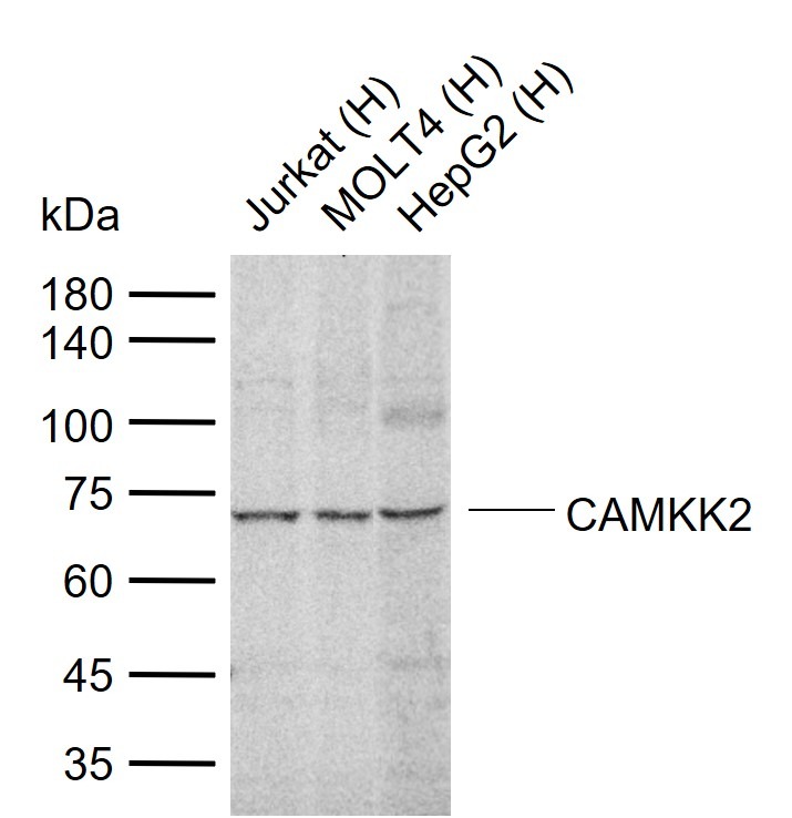 Anti-CAMKK2 Polyclonal Antibody