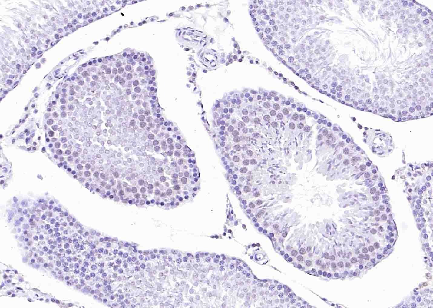 Anti-BRCA2 Polyclonal Antibody