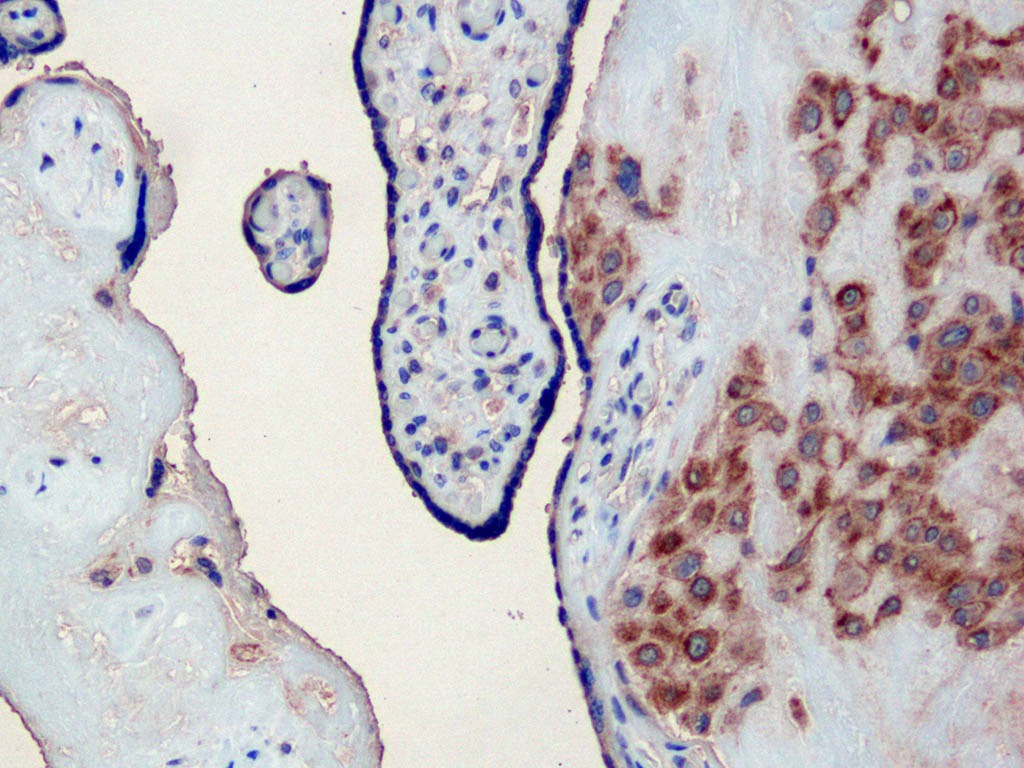 Anti-CXCL1 Polyclonal Antibody