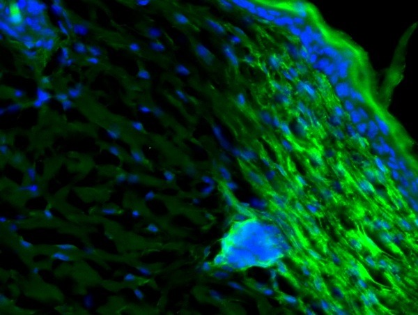 Anti-CXCL10 Polyclonal Antibody
