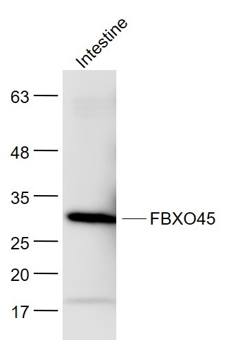 Anti-FBXO45 Polyclonal Antibody
