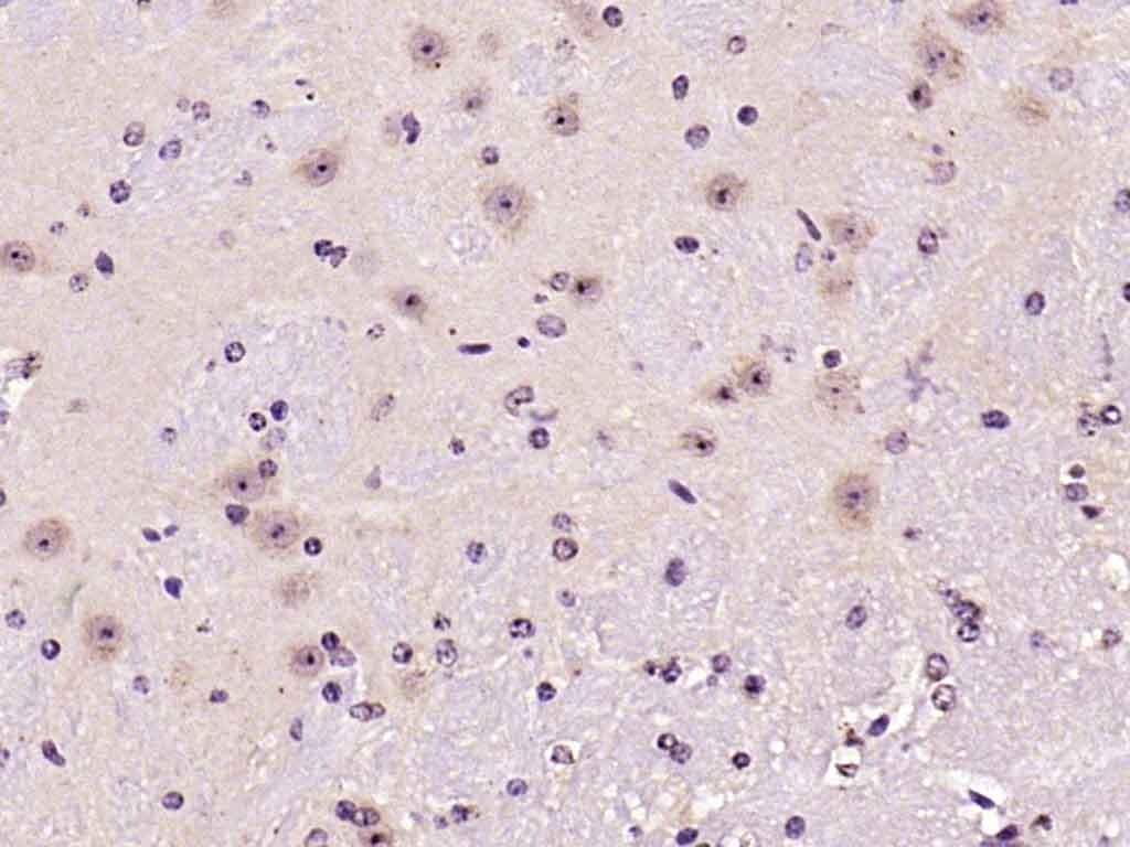 Anti-Ferritin heavy chain 1/FTH1 Polyclonal Antibody
