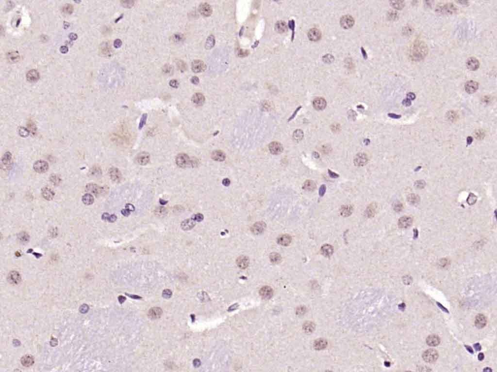 Anti-Ferritin heavy chain 1/FTH1 Polyclonal Antibody