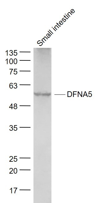 Anti-DFNA5 Polyclonal Antibody