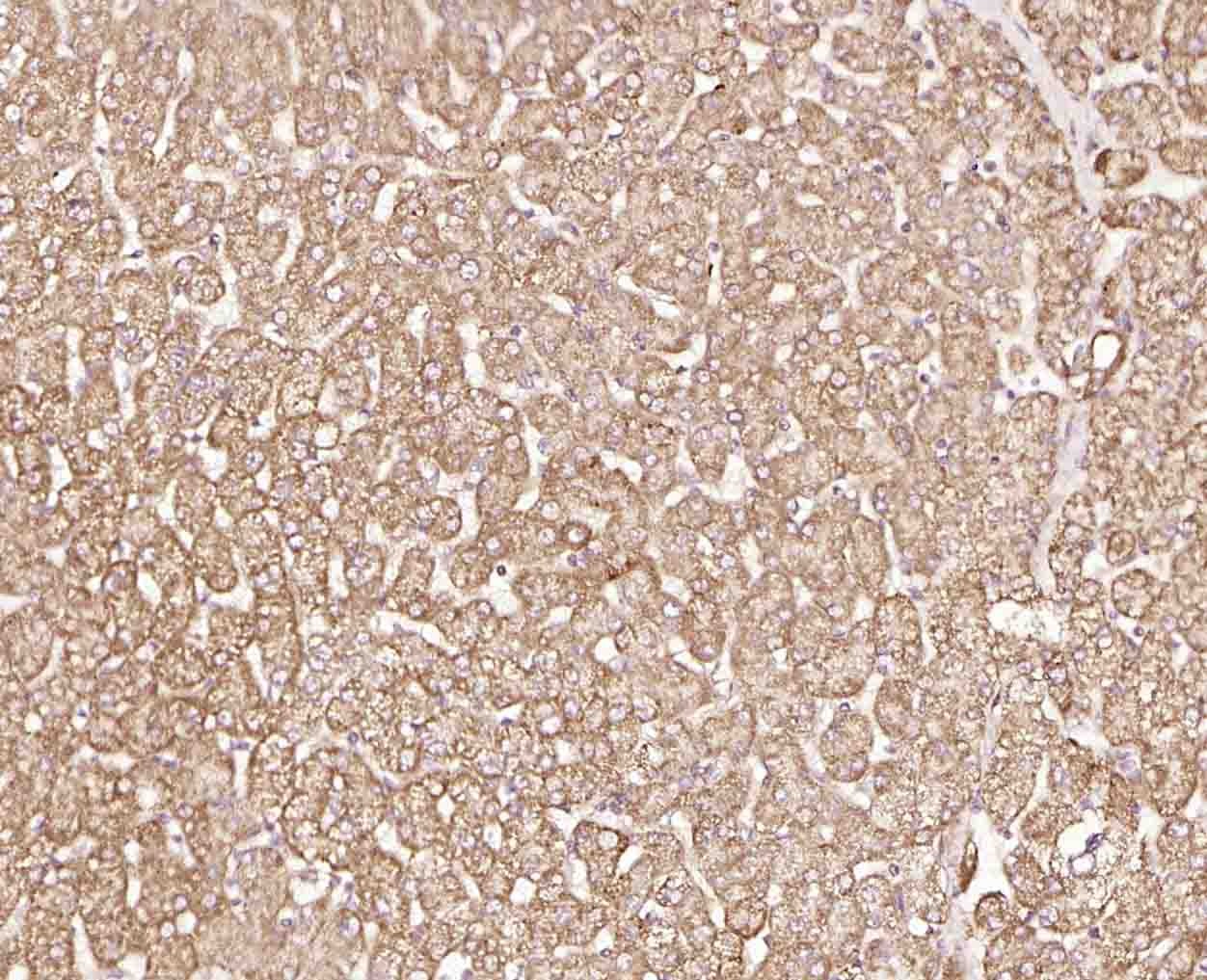 Anti-DGAT2 Polyclonal Antibody