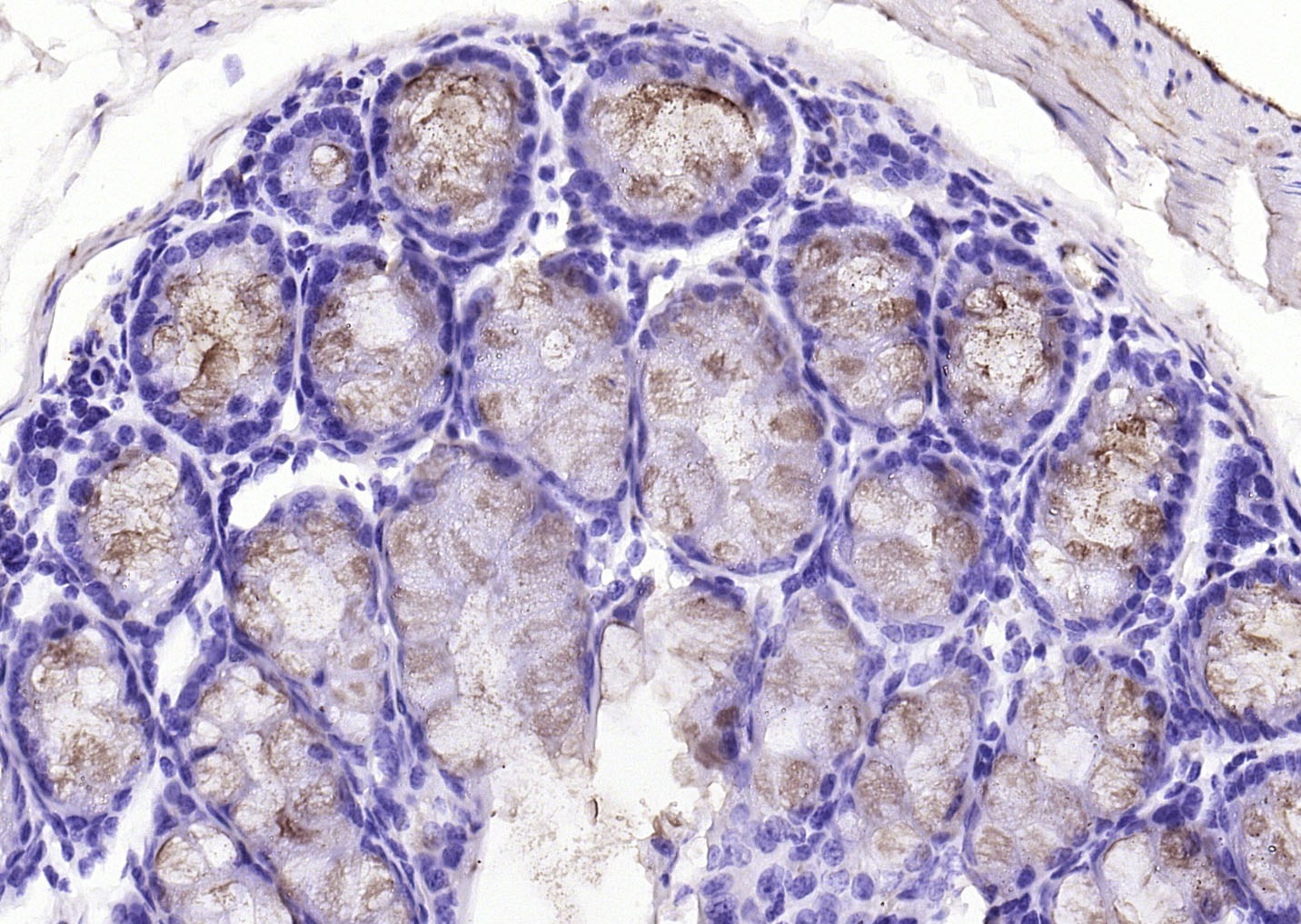 Anti-FCGBP Polyclonal Antibody