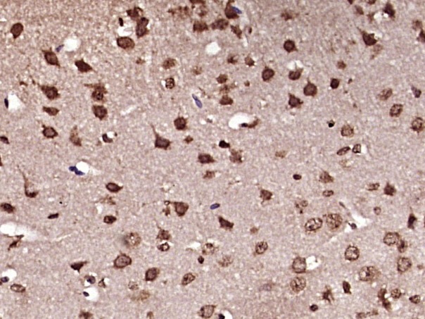 Anti-Ferritin heavy chain 1/FTH1 Polyclonal Antibody