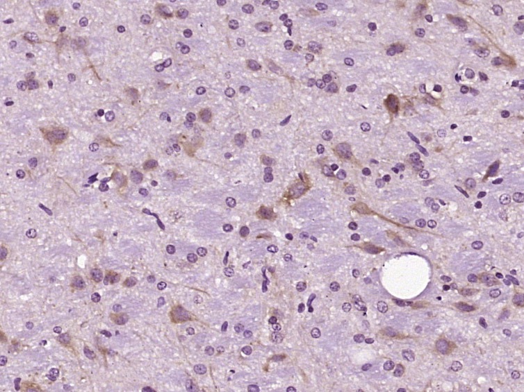 Anti-DIO2 Polyclonal Antibody