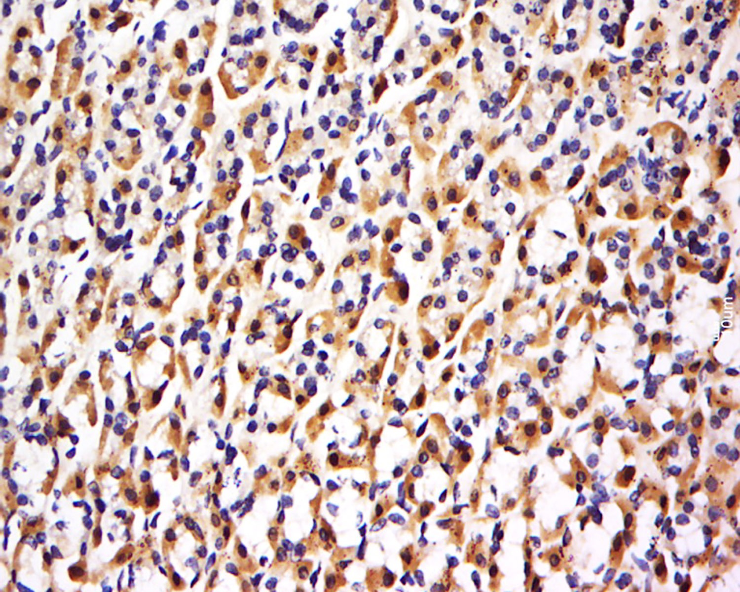 Anti-FBXO48 Polyclonal Antibody