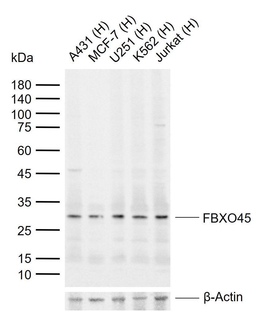 Anti-FBXO45 Polyclonal Antibody