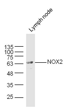 Anti-CYBB Polyclonal Antibody