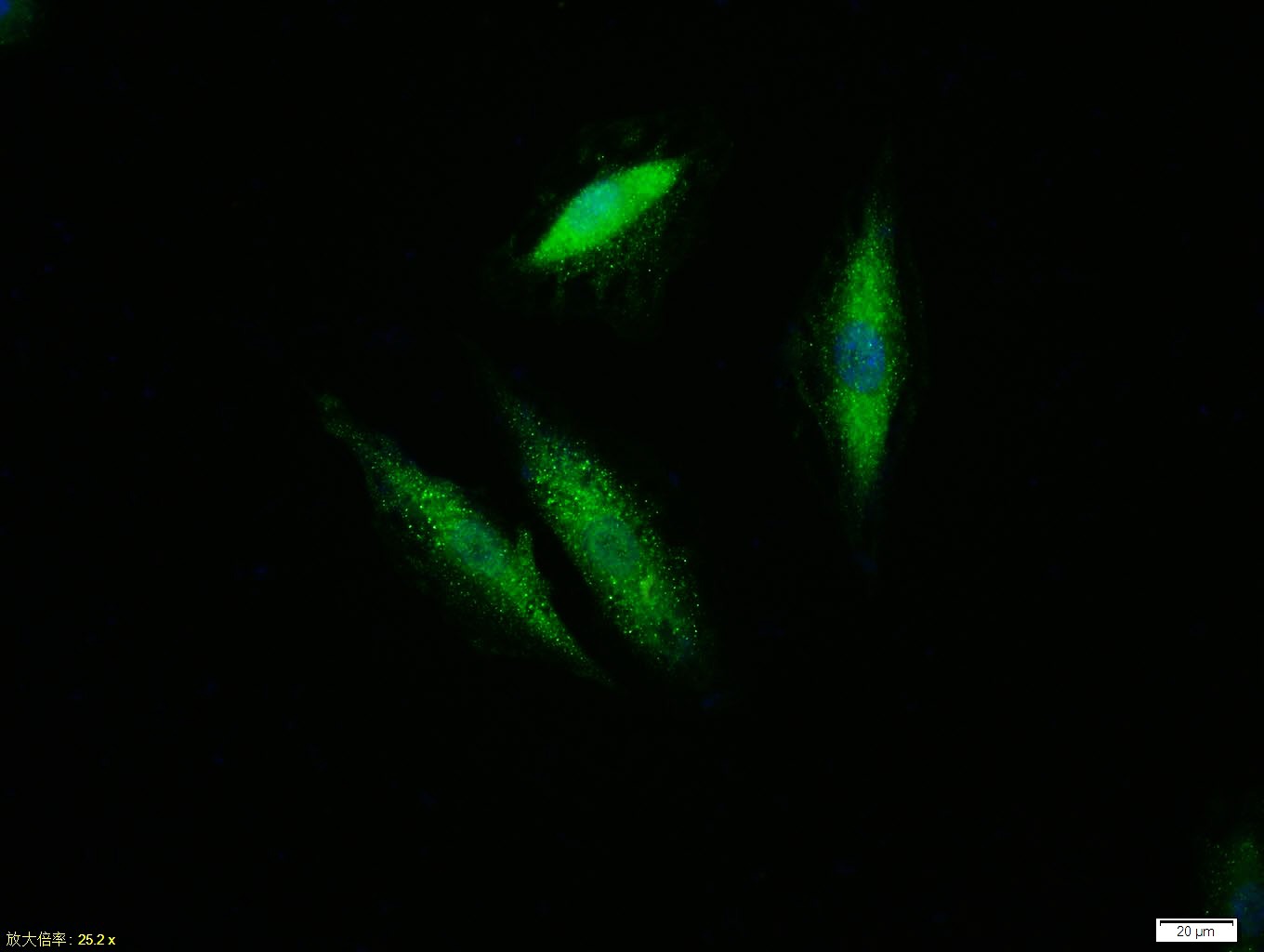 Anti-ERK1/2 Antibody (6Q27)