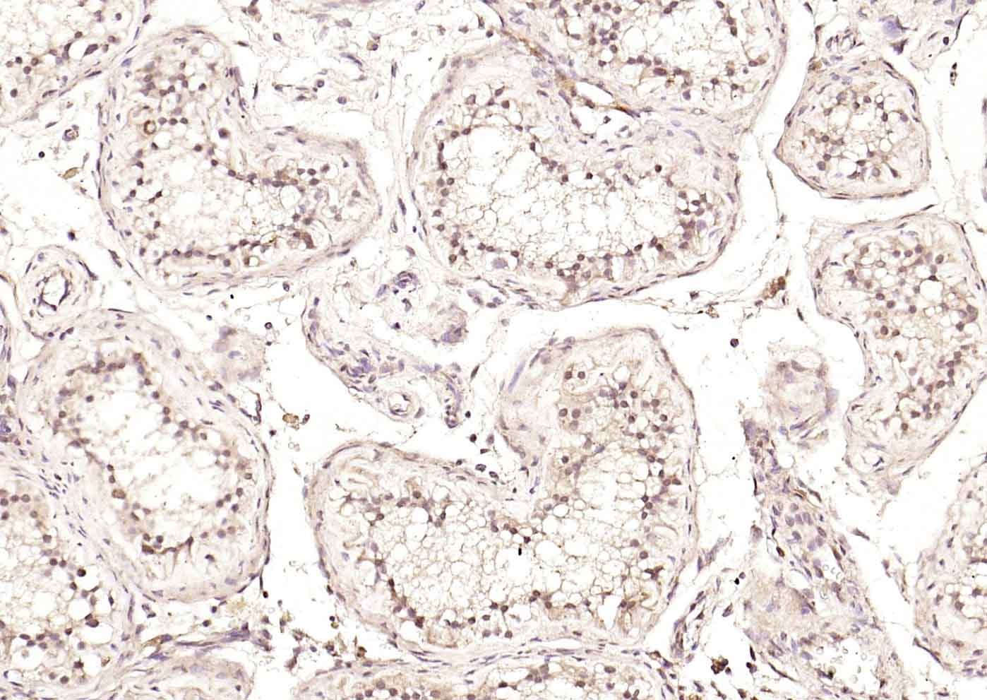 Anti-DLST Polyclonal Antibody