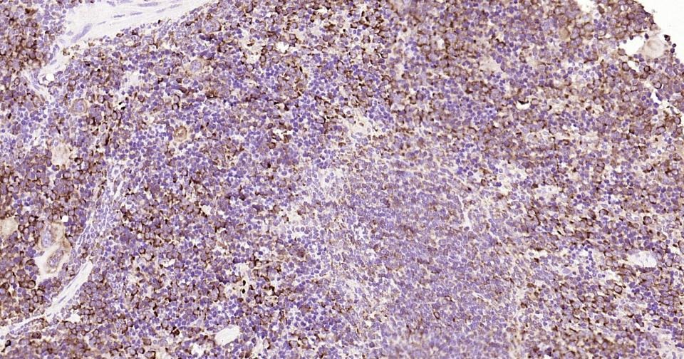 Anti-CXCR5 Antibody (3I647)