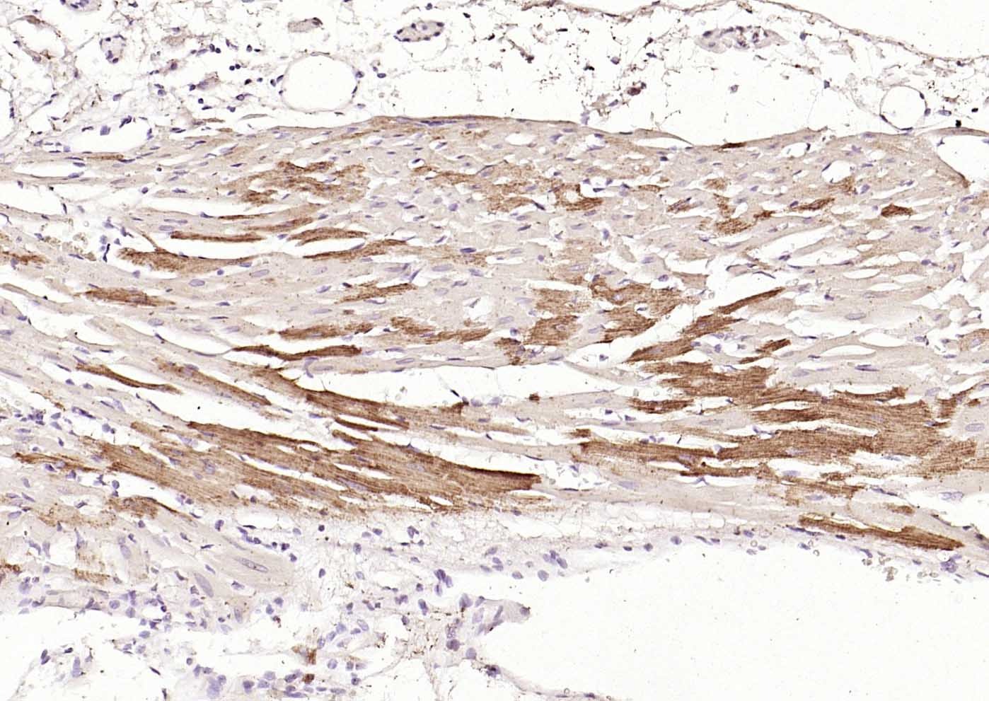 Anti-DLST Polyclonal Antibody