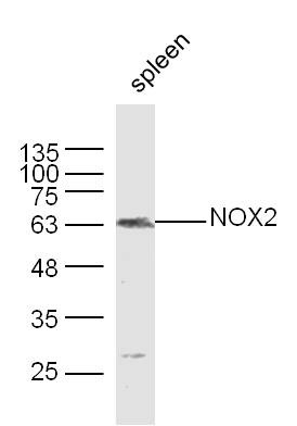 Anti-CYBB Polyclonal Antibody